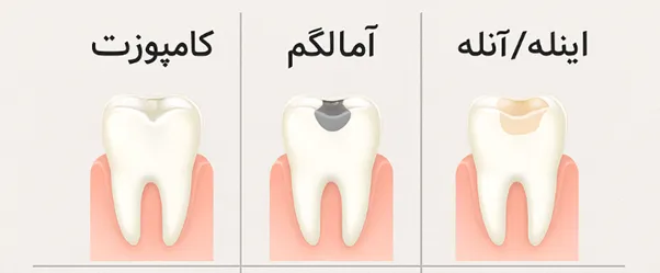 پیشگیری از پوسیدگی دندان