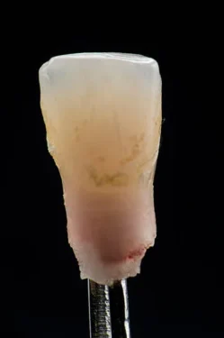 زمان نیاز به پست ریختگی