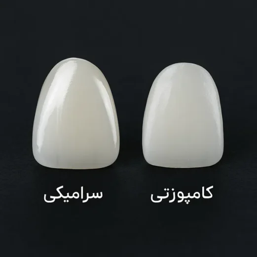 مراحل نصب لمینیت