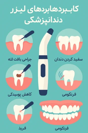 عملکرد لیزر روی دندان