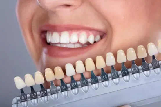 بیلداپ دندان بعد از عصب‌کشی