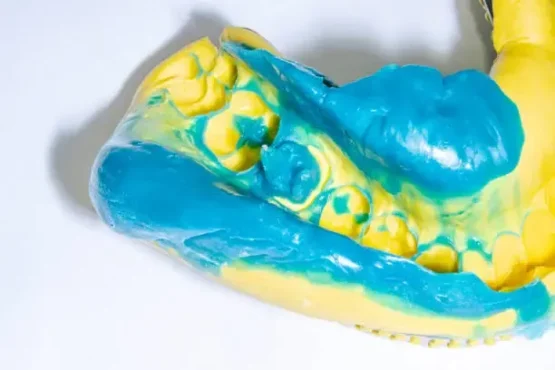 کاربرد پست ریختگی بعد از عصب‌کشی