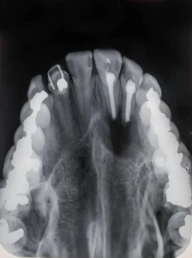 ساخت پست ریختگی