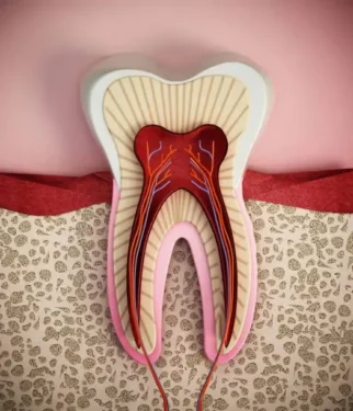 دندان سه کاناله