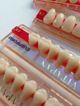 پروتز کامل دندان