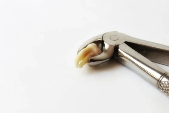 مقایسه ریشه ۱، ۲ و ۳ کانال